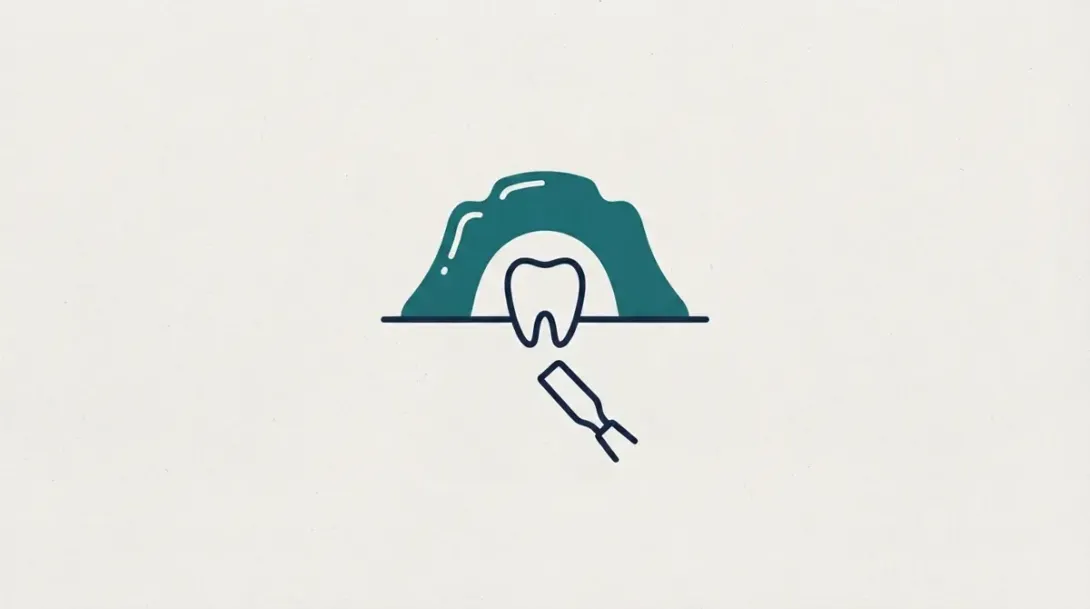 Instrumento dental acercándose a un diente con encía para realizar una gingivoplastia