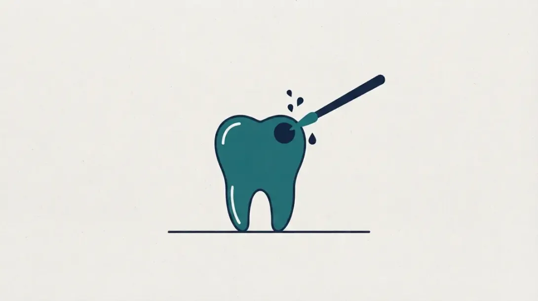 Aplicación de flúor diamino de plata sobre una caries en un diente con un pincel